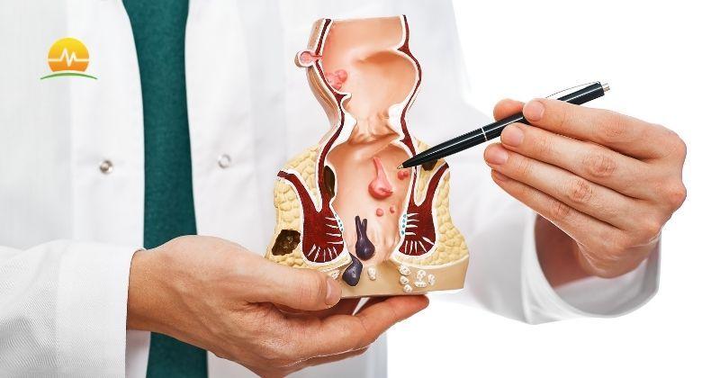 Colorectal Surgeon in points to hemorrhoids on model rectum to explain the common condition to a patient. Memorial Advanced Surgery logo at top left. 