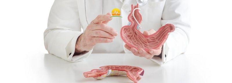 Bariatric surgeon in Jacksonville, FL holds a gastric band model as he discusses if the procedure is a good option for his patients
