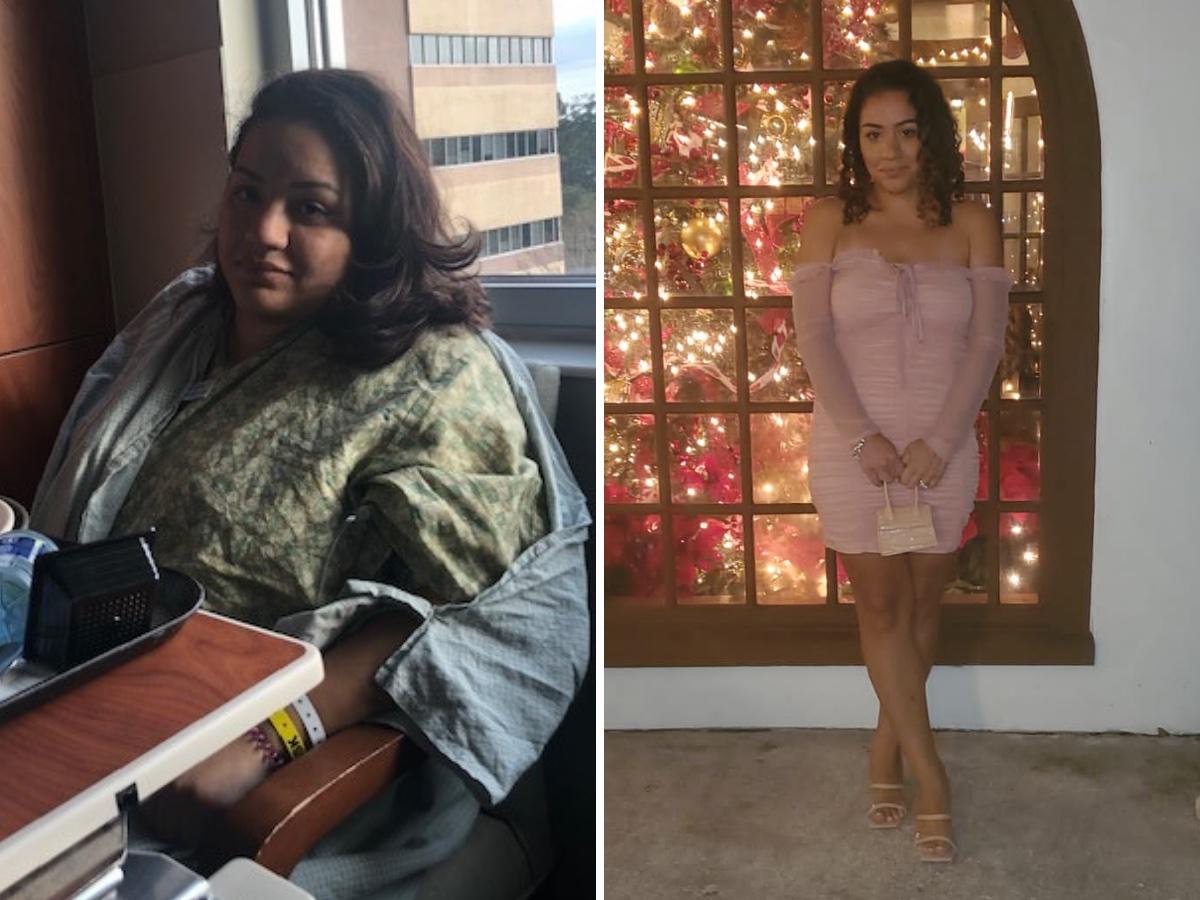 >Rosa - Vertical Sleeve Gastrectomy