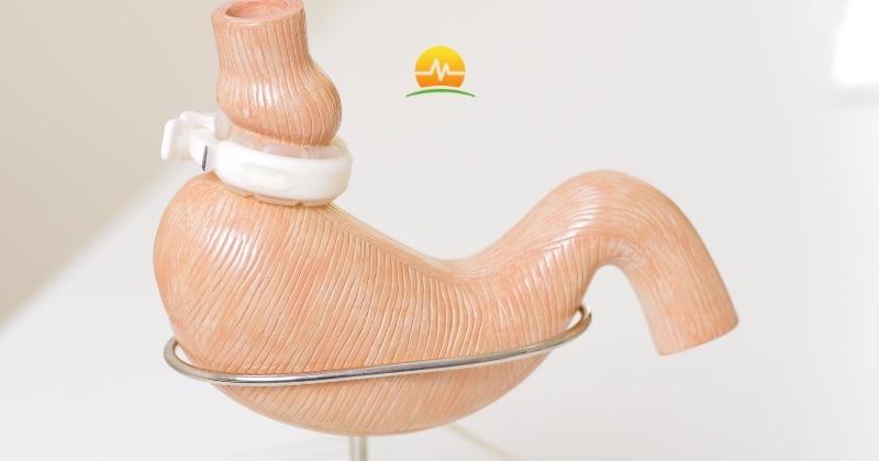 Why Is the Gastric Band Rarely Placed any Longer?