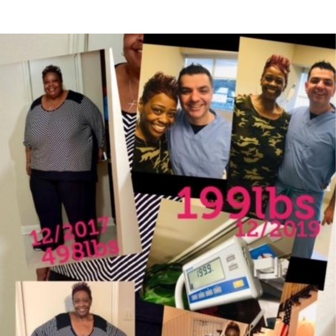 >Donita (Dee Dee) - Gastric Sleeve