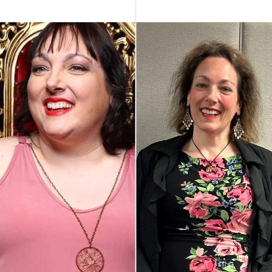 >Sandra - Robotic Gastric Division