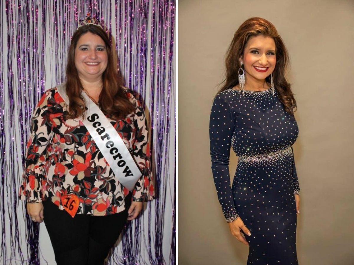 >Amanda - Gastric Sleeve