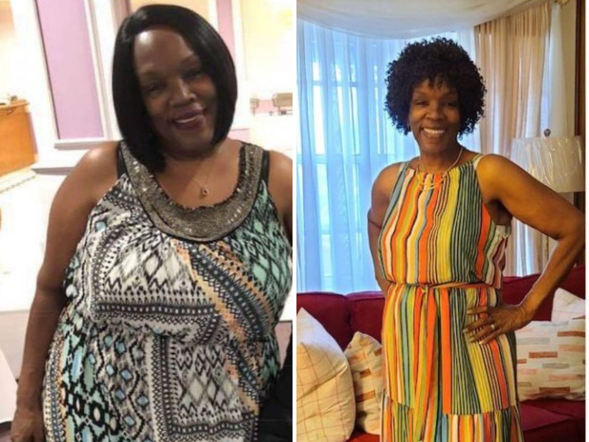 >Gwendolyn - Gastric Bypass