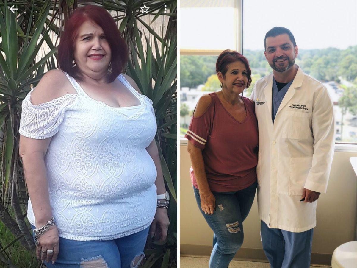 >Marie - Gastric Sleeve Patient