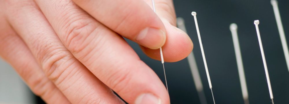 Closeup of fingers pinching acupuncture needle among other needles, treatment of acupuncture